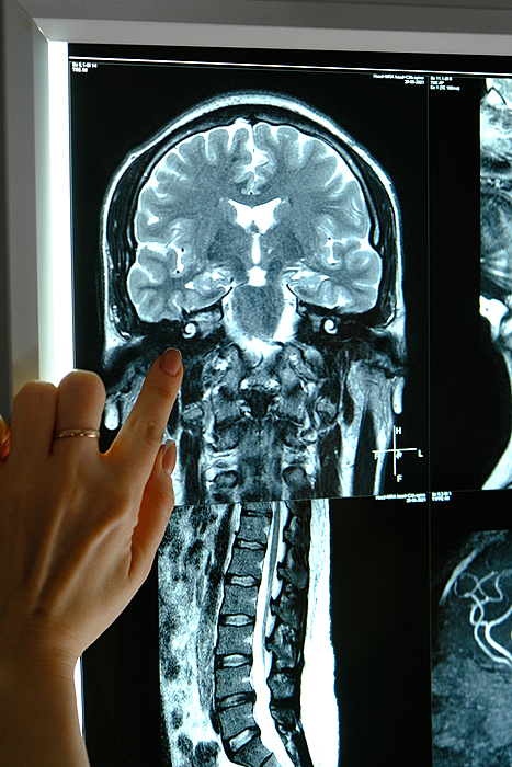 Дарим МРТ головного мозга!