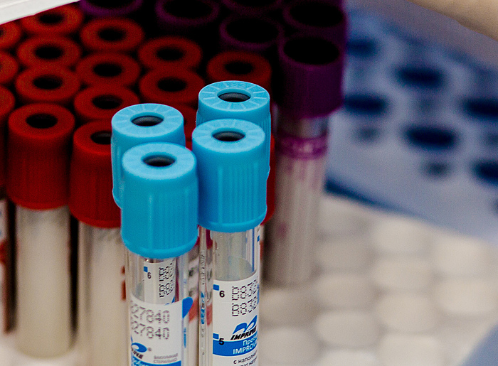 Планируете вакцинацию от Covid-19?