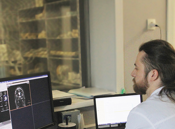 Головные боли после COVID-19